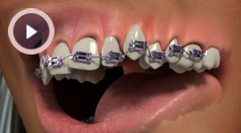 Orthodontics